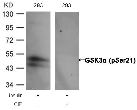 WB analysis of extracts from 293 cells treated with insulin or calf intestinal phosphatase (CIP) using GTX50095 GSK3 alpha (phospho Ser21) antibody.
