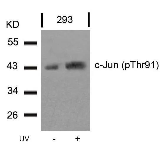 WB analysis of extracts from 293 cells untreated or treated with UV using GTX50100 c-Jun (phospho Thr91) antibody.