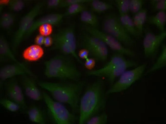 ICC/IF analysis of methanol-fixed HeLa cells using GTX50103 c-Jun (phospho Thr239) antibody. ICC/IF analysis of methanol-fixed HeLa cells using GTX50103 c-Jun (phospho Thr239) antibody.