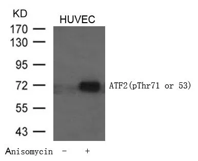 WB analysis of extracts from HUVEC cells untreated or treated with Anisomycin using GTX50109 ATF2 (phospho Thr71) antibody.