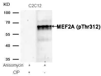 WB analysis of extracts from C2C12 cells treated with Anisomycin or calf intestinal phosphatase (CIP) using GTX50114 MEF2A (phospho Thr312) antibody.