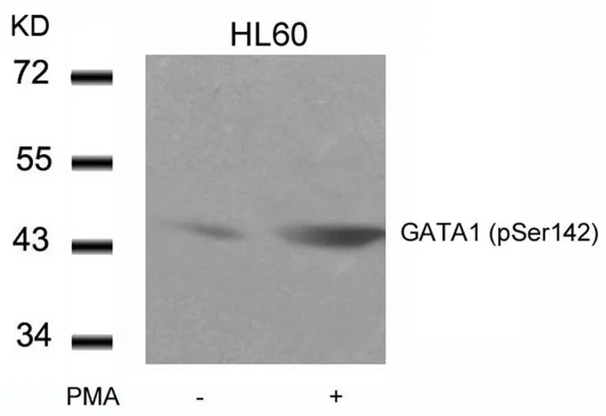 WB analysis of extracts from HL-60 cells untreated or treated with PMA using GTX50116 GATA1 (phospho Ser142) antibody.