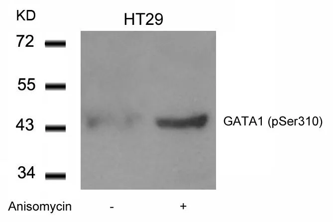 WB analysis of extracts from HT-29 cells untreated or treated with Anisomycin using GTX50117 GATA1 (phospho Ser310) antibody. WB analysis of extracts from HT-29 cells untreated or treated with Anisomycin using GTX50117 GATA1 (phospho Ser310) antibody.