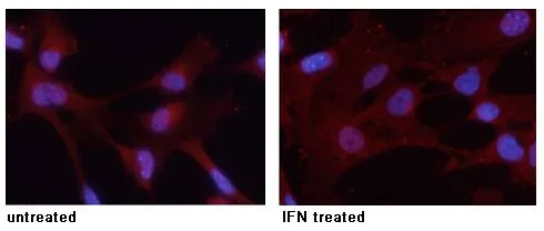 ICC/IF analysis of methanol-fixed MEF cells untreated or treated with IFN using GTX50119 STAT3 (phospho Tyr705) antibody. ICC/IF analysis of methanol-fixed MEF cells untreated or treated with IFN using GTX50119 STAT3 (phospho Tyr705) antibody.