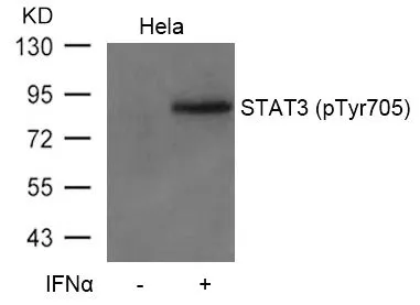WB analysis of extracts from HeLa cells untreated or treated with IFN a using GTX50119 STAT3 (phospho Tyr705) antibody.