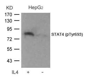 WB analysis of extracts from HepG2 cells untreated or treated with IL-4 using GTX50121 STAT4 (phospho Tyr693) antibody.