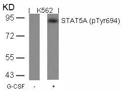 WB analysis of extracts from K562 cells untreated or treated with G-CSF using GTX50122 STAT5A (phospho Tyr694) antibody.