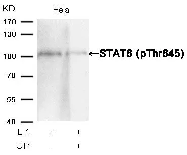 WB analysis of extracts from HeLa cells treated with IL-4 or calf intestinal phosphatase (CIP) using GTX50125 STAT6 (phospho Thr645) antibody.