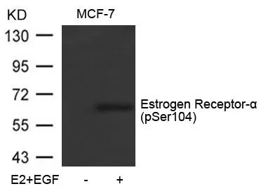 WB analysis of extracts from MCF-7 cells untreated or treated with E2 and EGF using GTX50137 Estrogen Receptor alpha (phospho Ser104) antibody.