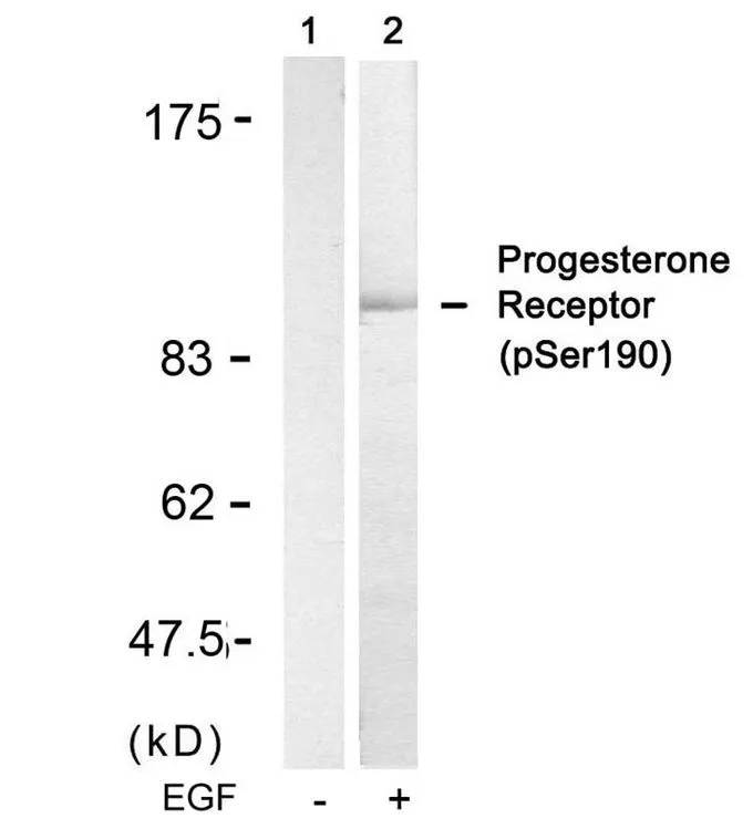 WB analysis of extracts from SKOV3 cells untreated (lane 1) or treated with EGF (lane 2) using GTX50141 Progesterone Receptor (phospho Ser190) antibody.