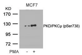 WB analysis of extracts from MCF cells untreated or treated with PMA using GTX50145 PKC mu (phospho Ser738) antibody.