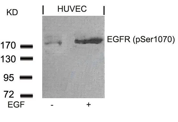 WB analysis of extracts from HUVEC cells untreated or treated with EGF using GTX50147 EGFR (phospho Ser1046) antibody.