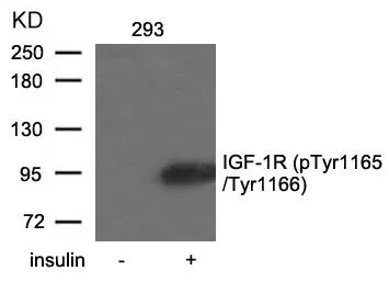 WB analysis of extracts from 293 cells untreated or treated with insulin using GTX50154 IGF1R beta (phospho Tyr1135 / Tyr1136) / Insulin Receptor beta (phospho Tyr1150 / Tyr1151) antibody.