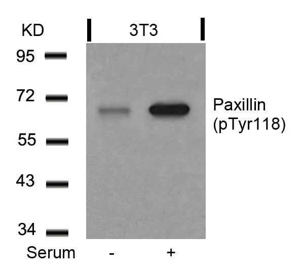 WB analysis of extracts from 3T3 cells untreated or treated with serum using GTX50155 Paxillin (phospho Tyr118) antibody.