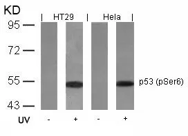 WB analysis of extracts from HT-29 and HeLa cells untreated or treated with UV using GTX50157 p53 (phospho Ser6) antibody.