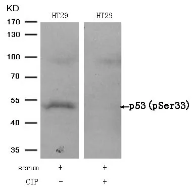 WB analysis of extracts from HT-29 cells treated with serum or calf intestinal phosphatase (CIP) using GTX50161 p53 (phospho Ser33) antibody.