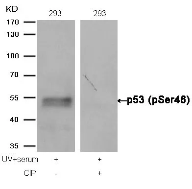 WB analysis of extracts from 293 cells treated with UV+serum or calf intestinal phosphatase (CIP) using GTX50163 p53 (phospho Ser46) antibody.