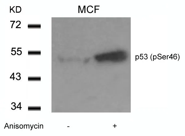 WB analysis of extracts from MCF cells untreated or treated with Anisomycin using GTX50163 p53 (phospho Ser46) antibody.
