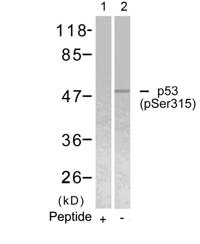 WB analysis of extracts from HeLa cells using GTX50164 p53 (phospho Ser315) antibody. Lane 1 : Primary antibody pre-incubated with the antigen specific peptide
