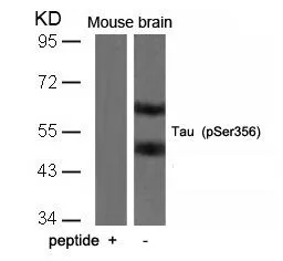 WB analysis of extracts from mouse brain tissue using GTX50165 Tau (phospho Ser356) antibody with or without blocking peptide.