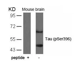 WB analysis of extracts from mouse brain tissue using GTX50166 Tau (phospho Ser396) antibody with or without blocking peptide.