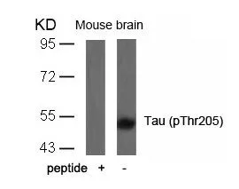WB analysis of extracts from mouse brain tissue using GTX50172 Tau (phospho Thr205) antibody with or without blocking peptide.