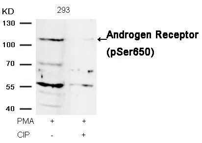 WB analysis of extracts from 293 cells treated with PMA or calf intestinal phosphatase (CIP) using GTX50183 Androgen Receptor (phospho Ser650) antibody.