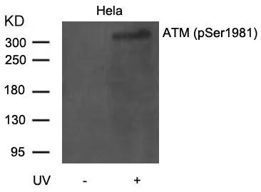 WB analysis of extracts from HeLa cells untreated or treated with UV using GTX50184 ATM (phospho Ser1981) antibody.