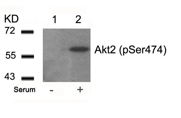 WB analysis of extracts from 293 cells untreated (lane 1) or treated with serum (lane 2) using GTX50186 AKT (phospho Ser473) antibody.