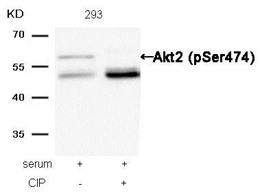 WB analysis of extracts from 293 cells treated with serum or calf intestinal phosphatase (CIP) using GTX50186 AKT (phospho Ser473) antibody.