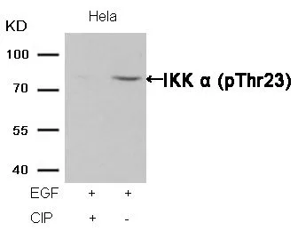 WB analysis of extracts from HeLa cells treated with EGF or calf intestinal phosphatase (CIP) using GTX50190 IKK alpha (phospho Thr23) antibody.