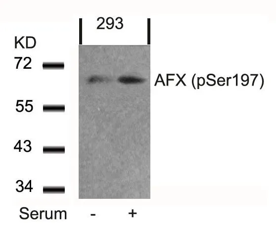 WB analysis of extracts from 293 cells untreated or treated with serum using GTX50197 FOXO4 (phospho Ser197) antibody.