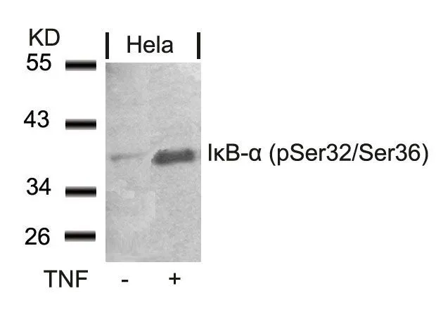 WB analysis of extracts from HeLa cells untreated or treated with TNF using GTX50209 IKB alpha (phospho Ser32/Ser36) antibody.