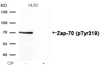 WB analysis of extracts from HL-60 cells treated with calf intestinal phosphatase (CIP) using GTX50214 ZAP70 (phospho Tyr319) antibody.