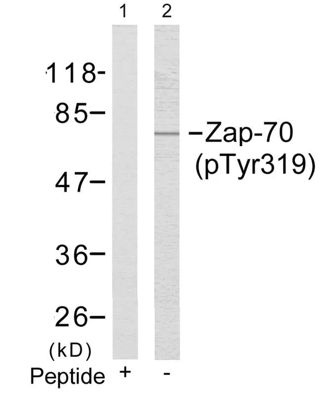 WB analysis of extracts from Jurkat cells using GTX50214 ZAP70 (phospho Tyr319) antibody. Lane 1 : Primary antibody pre-incubated with the antigen specific peptide