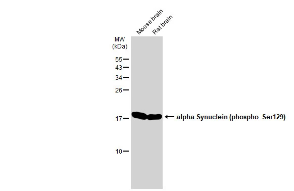 Various tissue extracts (50 microg) were separated by 15% SDS-PAGE, and the membrane was blotted with alpha Synuclein (phospho Ser129) antibody (GTX50222) diluted at 1:500. The HRP-conjugated anti-rabbit IgG antibody (GTX213110-01) was used to detect the primary antibody.