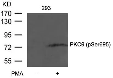 WB analysis of extracts from 293 cells untreated or treated with PMA using GTX50223 PKC theta (phospho Ser695) antibody.