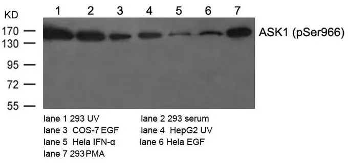 WB analysis of extracts from various cells using GTX50229 ASK1 (phospho Ser966) antibody.