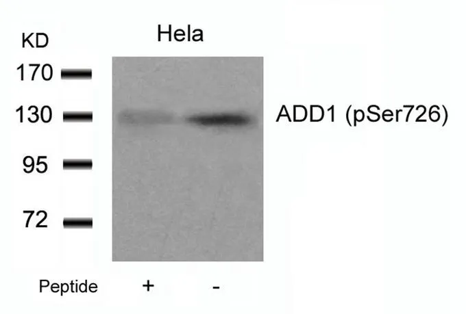 WB analysis of extracts from HeLa cells using GTX50230 alpha Adducin (phospho Ser726) antibody with or without blocking peptide.