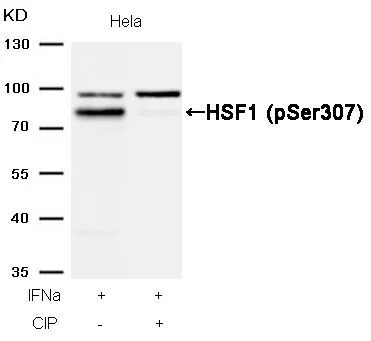 WB analysis of extracts from HeLa cells treated with IFNa or calf intestinal phosphatase (CIP) using GTX50239 HSF1 (phospho Ser307) antibody.