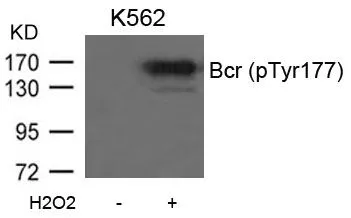 WB analysis of extracts from K562 cells untreated or treated with H2O2 using GTX50242 Bcr (phospho Tyr177) antibody.