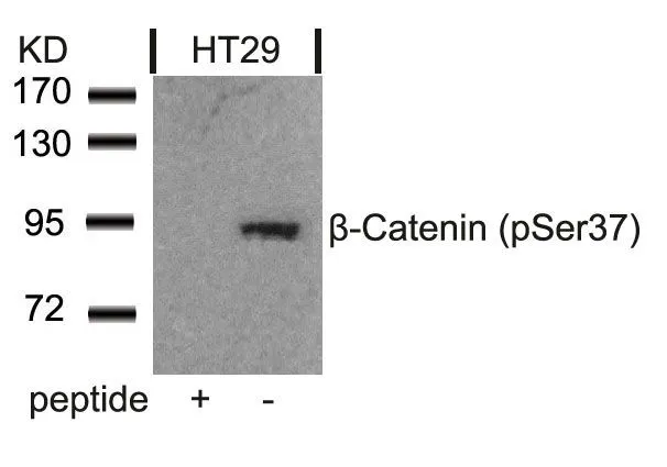 WB analysis of extracts from HT-29 cells using GTX50256 beta Catenin (phospho Ser37) antibody with or without blocking peptide.