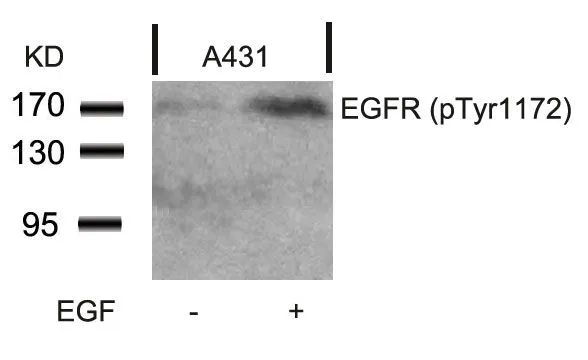 WB analysis of extracts from A431 cells untreated or treated with EGF using GTX50257 EGFR (phospho Tyr1148) antibody.