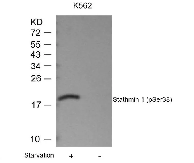 WB analysis of extracts from K562 cells untreated or treated with starvation using GTX50261 Stathmin 1 (phospho Ser38) antibody.