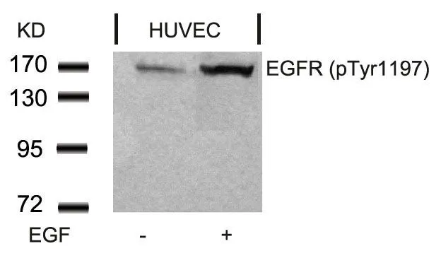 WB analysis of extracts from HUVEC cells untreated or treated with EGF using GTX50263 EGFR (phospho Tyr1173) antibody.