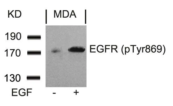 WB analysis of extracts from MDA cells untreated or treated with EGF using GTX50264 EGFR (phospho Tyr845) antibody. WB analysis of extracts from MDA cells untreated or treated with EGF using GTX50264 EGFR (phospho Tyr845) antibody.