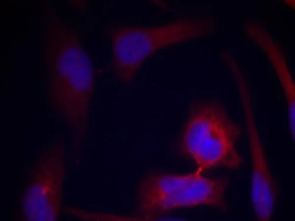ICC/IF analysis of methanol-fixed HeLa cells using GTX50267 RPS6 (phospho Ser235) antibody. ICC/IF analysis of methanol-fixed HeLa cells using GTX50267 RPS6 (phospho Ser235) antibody.