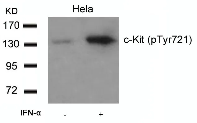 WB analysis of extracts from HeLa cells untreated or treated with IFN-a using GTX50271 c-Kit (phospho Tyr721) antibody.