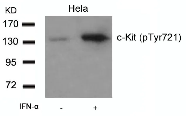 WB analysis of extracts from HeLa cells untreated or treated with IFN-a using GTX50271 c-Kit (phospho Tyr721) antibody. WB analysis of extracts from HeLa cells untreated or treated with IFN-a using GTX50271 c-Kit (phospho Tyr721) antibody.