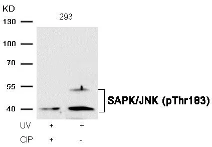 WB analysis of extracts from 293 cells treated with UV or calf intestinal phosphatase (CIP) using GTX50278 JNK (phospho Thr183) antibody.